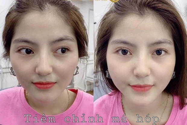 Bạn g&aacute;i tin đồn Quang Hải thăng hạng nhan sắc nhờ chỉnh sửa? - Ảnh 3