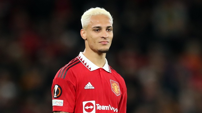 Man United thiệt qu&acirc;n nghi&ecirc;m trọng ở m&agrave;n t&aacute;i đấu Real Betis - Ảnh 1