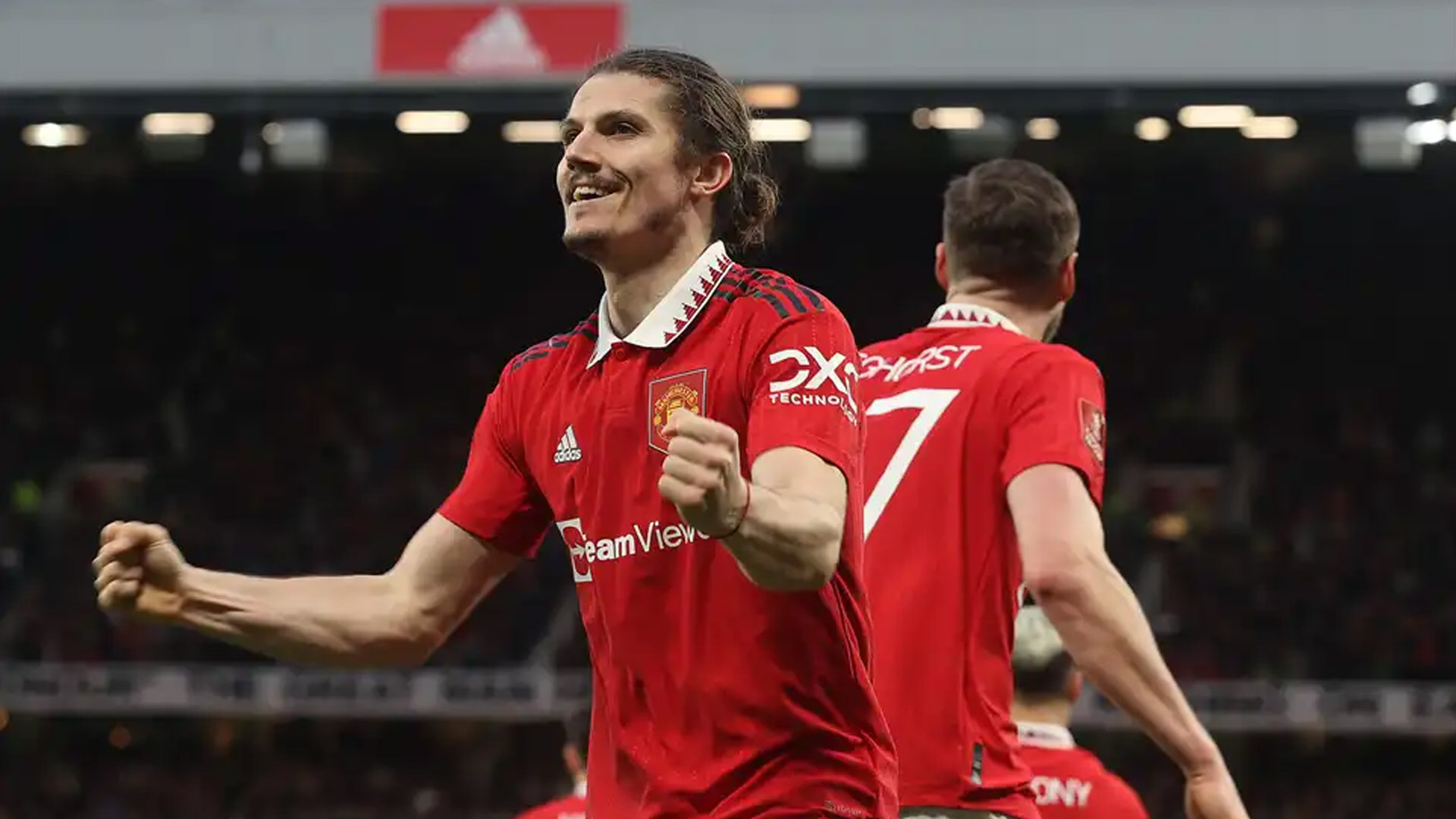 Cập nhật t&igrave;nh h&igrave;nh chấn thương của Rashford - Ảnh 2