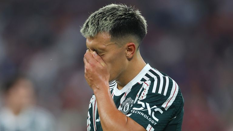 Phải l&ecirc;n b&agrave;n mổ, trụ cột M.U nghỉ thi đấu đến hết năm 2023 - Ảnh 1