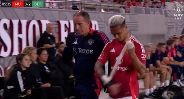 MU khủng hoảng nặng nề trước trận si&ecirc;u c&uacute;p Anh với Man City - Ảnh 1