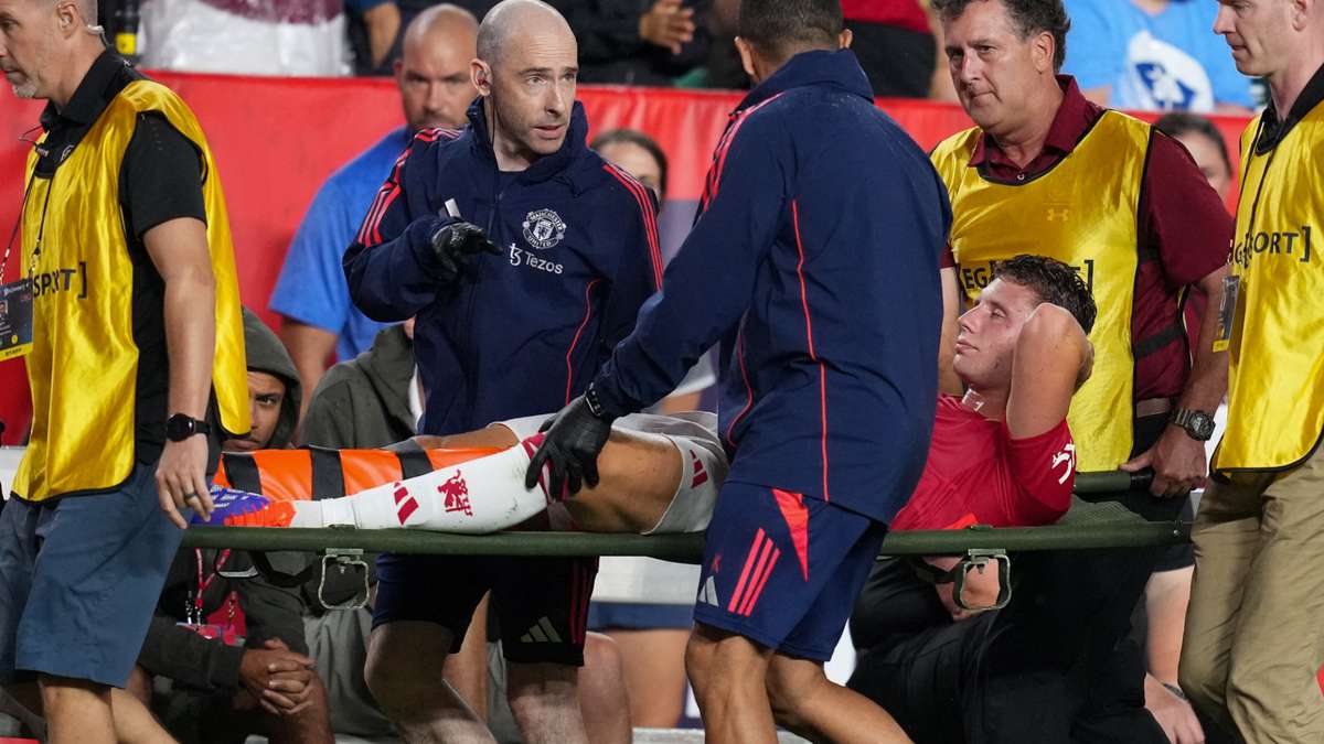 MU gặp &aacute;c mộng chấn thương trước trận si&ecirc;u c&uacute;p Anh với Man City - Ảnh 1