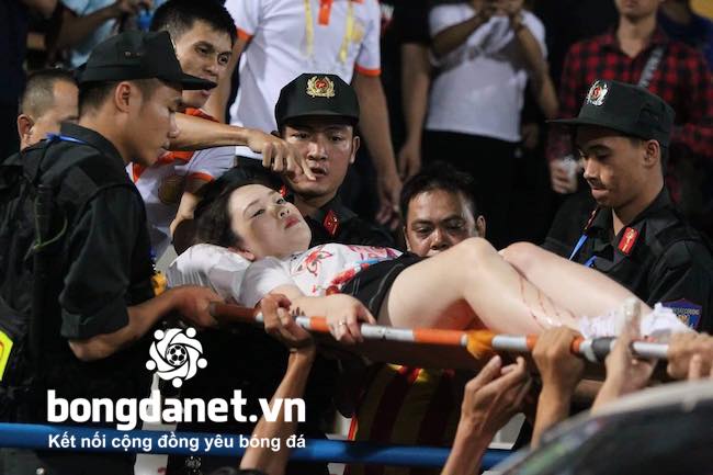 CĐV nữ bị trúng pháo sáng được chi trả toàn bộ viện phí