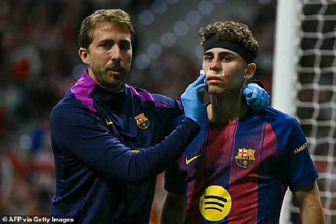 Cầu thủ Barcelona đổ máu vì bị đối thủ đạp giày vào mặt