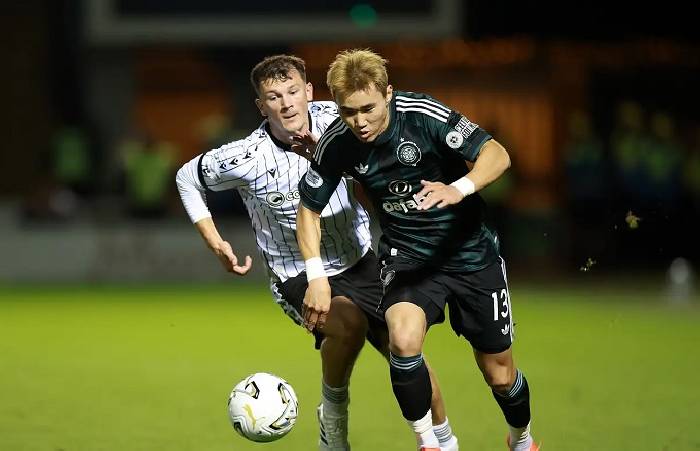 Nhận định, soi kèo Celtic vs Celta Vigo, 2h00 ngày 23/10: Kém cỏi như nhau