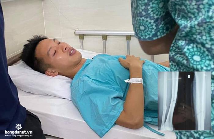 X&oacute;t xa khi xem kết quả chụp X-quang ch&acirc;n phải H&ugrave;ng Dũng