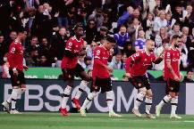 Vừa đ&ograve;i l&agrave;m anti s&aacute;ng mắt ra, cựu sao M.U bị cấm thi đấu 4 năm