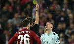 Bayern Munich mất trụ cột ở lượt về v&ograve;ng 1/8 C&uacute;p C1 với Liverpool