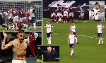 Nhận định West Ham vs Manchester City, 18h30 ng&agrave;y 24/10