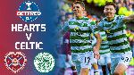 Nhận định Hearts vs Celtic, 21h00 ng&agrave;y 25/5 (FA Cup Scotland)