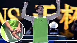 Alcaraz bị phát hiện sử dụng ‘thiết bị cấm’ ở vòng 4 Úc Mở rộng 2026
